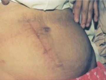 san-phu-tu-sinh-con-tai-nha-con-trai-8-tuoi-chinh-la-nguoi-do-de