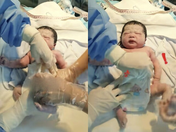 be-so-sinh-chao-doi-bi-bac-si-va-y-ta-lien-tuc-tac-dong-ngay-tren-ban-mo-nguoi-me-roi-rit-cam-on