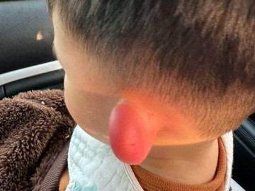 con-qua-nha-hang-xom-choi-ve-nha-lo-tai-bong-sung-vu-bien-dang-dua-vao-vien-bac-si-khen-me-gioi