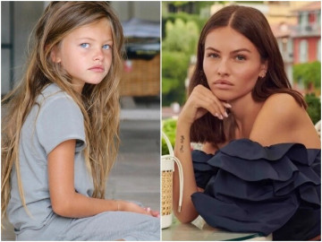 co-be-co-guong-mat-dep-nhat-the-gioi-19-nam-sau-mot-tay-gay-dung-de-che-tram-ty-day-thi-lot-xac-khac-han