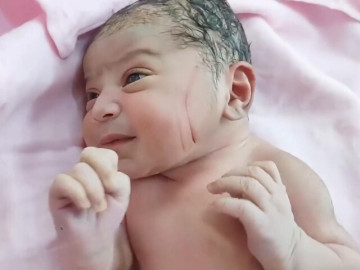 vua-roi-phong-de-phat-hien-nhieu-vet-thuong-tren-mat-con-so-sinh-gia-dinh-nghi-ngo-bac-si-tac-trach-doi-kien