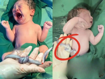 em-be-chao-doi-ben-vat-the-la-khien-ca-e-kip-dung-tim-hanh-dong-tuyet-voi-cua-me-khi-mang-bau-da-cuu-lay-con