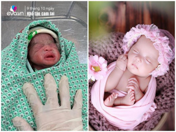 me-ha-noi-mang-bau-doi-29-tuan-di-sinh-chi-be-duoc-mot-con-tren-tay