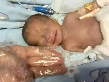 me-lap-ky-luc-sinh-non-dua-be-chi-bang-1-qua-tao-tinh-trang-hien-tai-sau-128-ngay-gay-xuc-dong