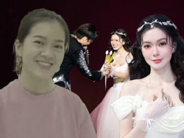 nhan-sac-nang-tho-moi-cua-soobin-sau-man-phau-thuat-tham-my-dai-thanh-cong-hien-tai-truoc-kia-nhu-hai-nguoi-khac